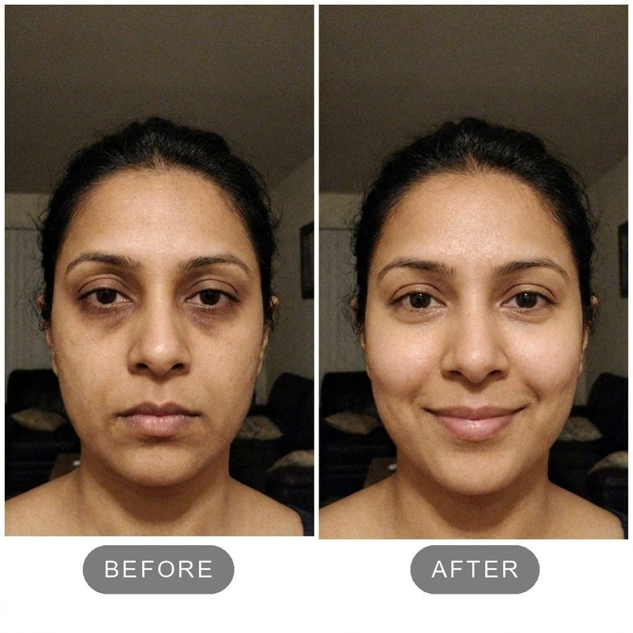 Before and after